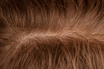 Image of a zoomed-in scalp.
