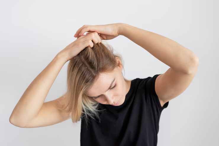 Image of a girl with a dry scalp from protein overload.