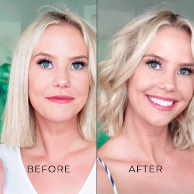 Before and after using TYME Iron Pro: Limelight on woman with short hair.